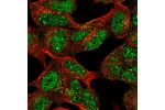 Immunofluorescent staining of human cell line SH-SY5Y shows localization to nucleoplasm & vesicles.