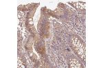 Immunohistochemical staining of human colon shows moderate cytoplasmic and luminal membranous positivity in glandular cells.