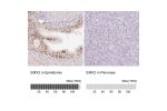 Immunohistochemistry analysis in human epididymis and pancreas tissues using Anti-EMX2 antibody. Corresponding EMX2 RNA-seq data are presented for the same tissues.