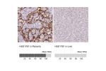 Immunohistochemistry analysis in human placenta and prostate tissues using Anti-HSD17B1 antibody. Corresponding HSD17B1 RNA-seq data are presented for the same tissues.