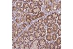 Immunohistochemical staining of human stomach shows moderate cytoplasmic positivity in glandular cells.