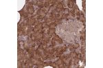 Immunohistochemical staining of human pancreas shows cytoplasmic positivity in exocrine cells.