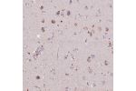Immunohistochemical staining of human lymph node shows strong cytoplasmic positivity in non-germinal center cells.