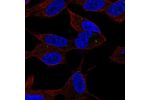 Immunofluorescent staining of human cell line SH-SY5Y shows localization to vesicles.