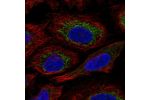 Immunofluorescent staining of human cell line SiHa shows localization to mitochondria.