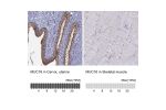 Immunohistochemistry analysis in human cervix, uterine and skeletal muscle tissues using Anti-MUC16 antibody. Corresponding MUC16 RNA-seq data are presented for the same tissues.