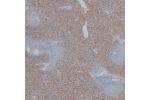 Immunohistochemical staining of human spleen shows weak to moderate cytoplasmic positivity in cells in red pulp.