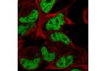Immunofluorescent staining of human cell line RH-30 shows localization to nucleoplasm.