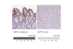 Immunohistochemistry analysis in human duodenum and liver tissues using HPA065947 antibody. Corresponding AQP10 RNA-seq data are presented for the same tissues.