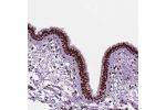 Immunohistochemical staining of human bronchus shows strong nuclear positivity in respiratory epithelial cells.