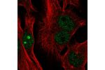 Immunofluorescent staining of human cell line SK-MEL-30 shows localization to nucleus & nucleoli.