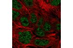 Immunofluorescent staining of human cell line CACO-2 shows localization to nucleoplasm.