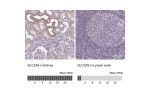 Immunohistochemistry analysis in human kidney and lymph node tissues using Anti-SLC2A9 antibody. Corresponding SLC2A9 RNA-seq data are presented for the same tissues.