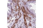 Immunohistochemical staining of human prostate shows strong cytoplasmic positivity in smooth muscle cells.