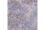 Immunohistochemical staining of human ovary shows positivity in plasma.