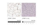 Immunohistochemistry analysis in human breast and liver tissues using HPA066302 antibody. Corresponding GPIHBP1 RNA-seq data are presented for the same tissues.