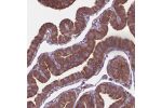 Immunohistochemical staining of human fallopian tube shows strong cytoplasmic positivity in glandular cells.