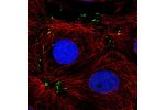 Immunofluorescent staining of human cell line MCF7 shows localization to focal adhesion sites.