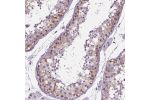 Immunohistochemical staining of human testis shows moderate cytoplasmic positivity in cells in seminiferous ducts.