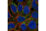 Immunofluorescent staining of human cell line RT4 shows localization to plasma membrane & vesicles.
