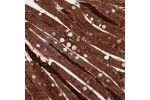 Immunohistochemical staining of human small intestine shows strong cytoplasmic positivity in glandular cells.