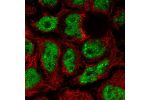 Immunofluorescent staining of human cell line CACO-2 shows localization to nucleoplasm & nuclear bodies.