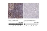 Immunohistochemistry analysis in human lymph node and skeletal muscle tissues using Anti-DOK2 antibody. Corresponding DOK2 RNA-seq data are presented for the same tissues.