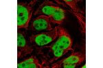 Immunofluorescent staining of human cell line CACO-2 shows localization to nucleoplasm.
