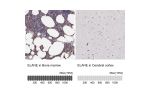 Immunohistochemistry analysis in human bone marrow and cerebral cortex tissues using Anti-ELANE antibody. Corresponding ELANE RNA-seq data are presented for the same tissues.