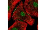 Immunofluorescent staining of human cell line A549 shows localization to nucleoplasm & cell junctions.