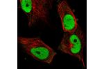 Immunofluorescent staining of human cell line U-251 MG shows localization to nucleoplasm.