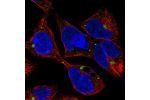 Immunofluorescent staining of human cell line HEK 293 shows localization to aggresome & vesicles.