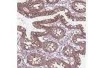 Immunohistochemical staining of human kidney shows strong cytoplasmic and membranous positivity in renal tubules.