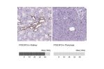 Immunohistochemistry analysis in human kidney and pancreas tissues using HPA067151 antibody. Corresponding POU3F3 RNA-seq data are presented for the same tissues.