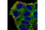 Immunofluorescent staining of human cell line RT4 shows localization to cytosol.