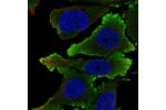 Immunofluorescent staining of human cell line PC-3 shows localization to plasma membrane.