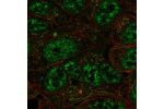Immunofluorescent staining of human cell line RT4 shows localization to nuclear speckles & microtubule organizing center.
