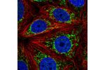 Immunofluorescent staining of human cell line MCF7 shows localization to mitochondria.