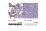 Immunohistochemistry analysis in human placenta and pancreas tissues using HPA067290 antibody. Corresponding AMOT RNA-seq data are presented for the same tissues.