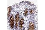 Immunohistochemical staining of human colon shows strong cytoplasmic positivity in glandular cells.