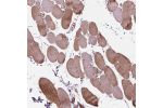 Immunohistochemical staining of human testis shows moderate nuclear and cytoplasmic positivity in seminiferous ducts and Leydig cells.