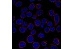 Immunofluorescent staining of human cell line REH shows localization to vesicles.