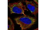 Immunofluorescent staining of human cell line HeLa shows localization to mitochondria.
