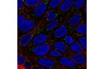 Immunofluorescent staining of human cell line RT4 shows localization to vesicles.