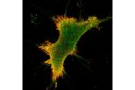 Immunofluorescent staining of human cell line AF22 shows localization to plasma membrane & cytosol.