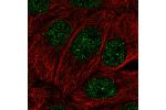 Immunofluorescent staining of human cell line HaCaT shows localization to nucleoplasm.