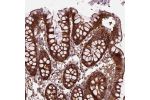 Immunohistochemical staining of human colon shows strong cytoplasmic and membranous positivity in glandular cells.