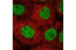 Immunofluorescent staining of human cell line A-431 shows localization to nucleoplasm.