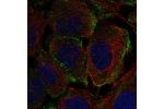Immunofluorescent staining of human cell line A-431 shows localization to plasma membrane & vesicles.