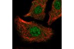 Immunofluorescent staining of human cell line A549 shows localization to nucleoplasm.